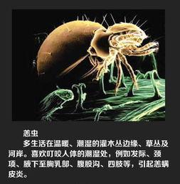 绍兴新闻爆料平台蜱虫,惊现蜱虫隐患,专家提醒防范措施! 第1张 绍兴新闻爆料平台蜱虫,惊现蜱虫隐患,专家提醒防范措施! 第1张